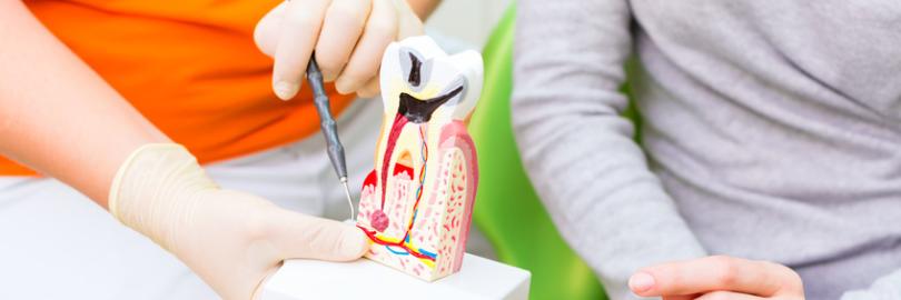 Zahnarzt erklärt Patientin am einem Modell eine Wurzelbehandlung