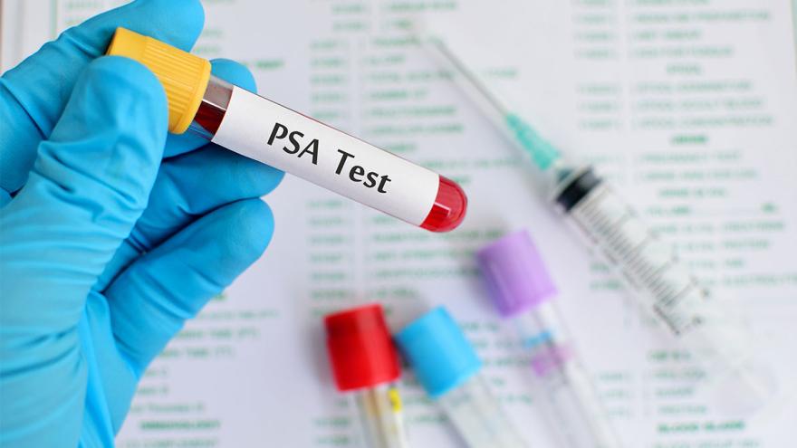 prueba psa nach próstata op prueba psa nach próstata op
